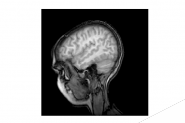 Python读取MRI并显示为灰度图像实例代码