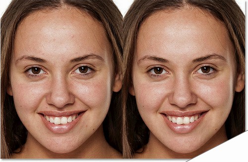 Photoshop快速消除人物脸部的痘痘并把肤色柔和处理